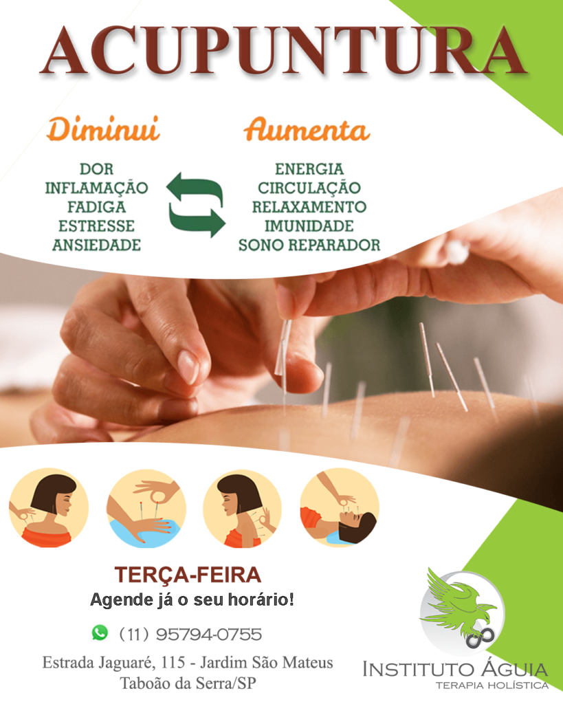 Acupuntura Acupuntura